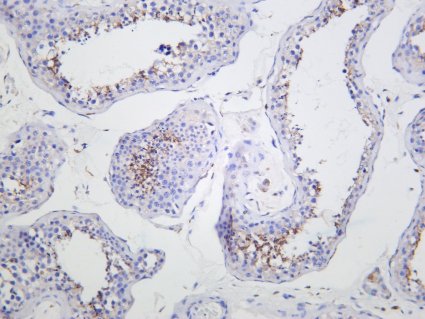 Recombinant CD206/MRC1 Monoclonal Antibody - 3