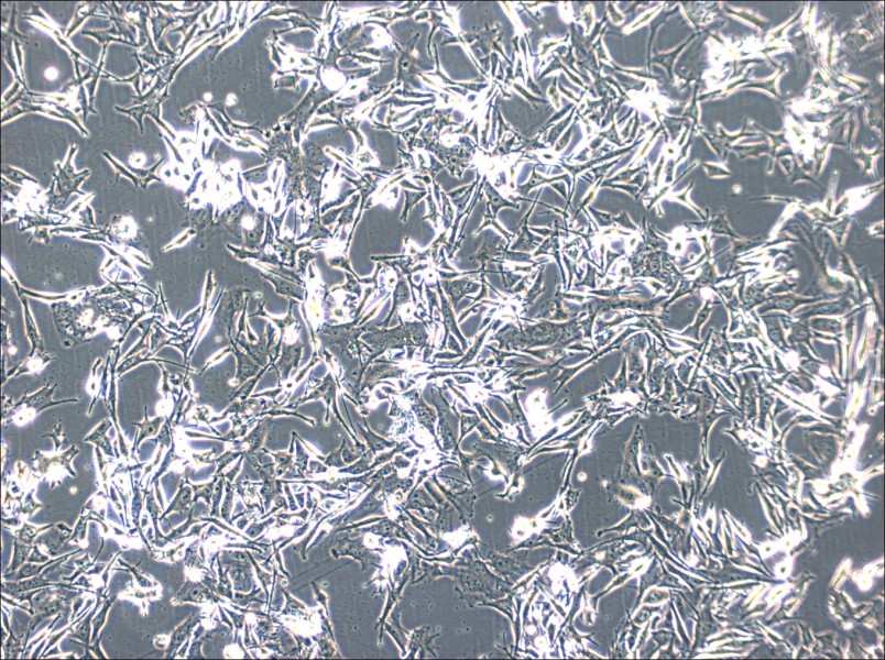 SK-MEL-2 Cell Complete Medium - small - 2