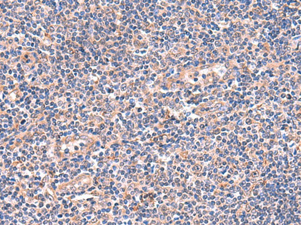 Immunohistochemistry of paraffin-embedded Human tonsil tissue  using OSBPL2 Polyclonal Antibody at dilution of 1:55(?200)