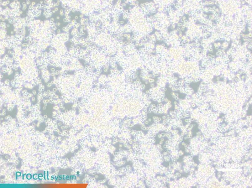EL-4-B5 Cell Complete Medium - 1