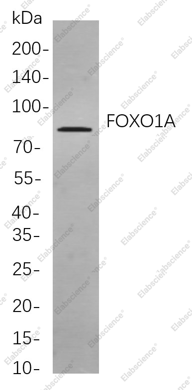 Recombinant FOXO1A Monoclonal Antibody - 1