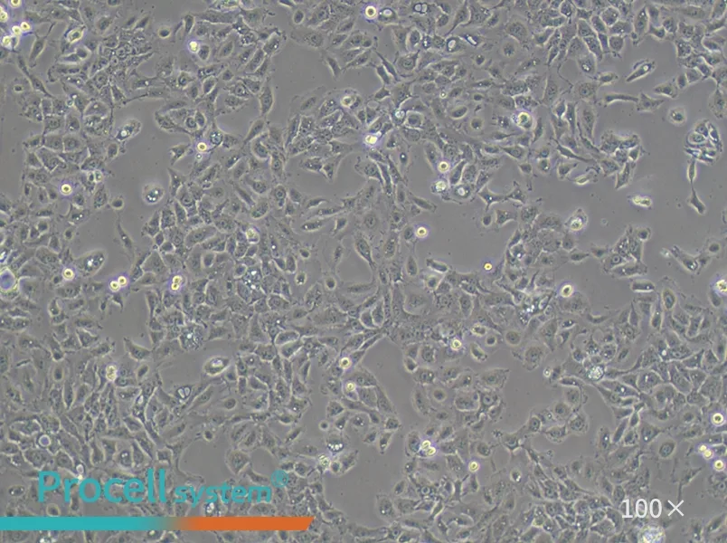 NCI-H292 Cell Complete Medium - 2