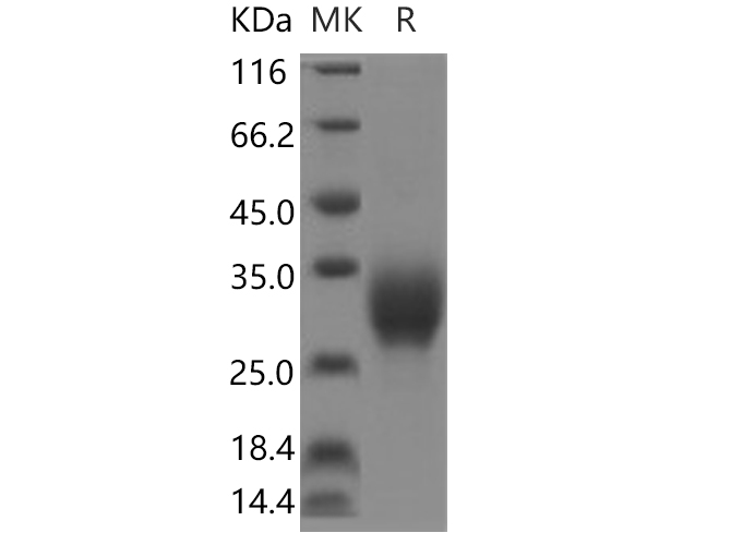 Recombinant Human TGFβ1 Protein-产品推荐-1