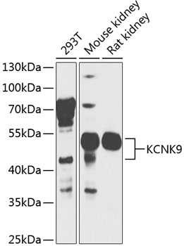 Western blot analysis of extracts of various cell lines using KCNK9 Polyclonal Antibody at 1:1000 dilution.