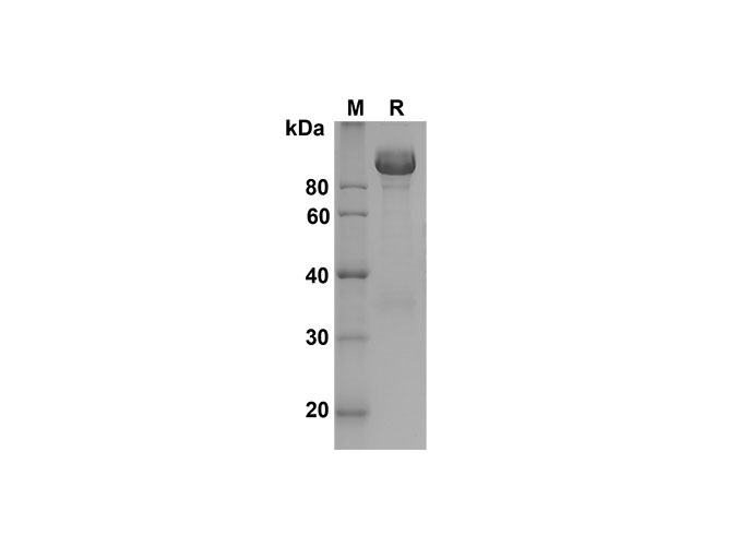 Recombinant Mouse Fas/TNFRSF6/CD95 Protein(His Tag)-产品推荐-1