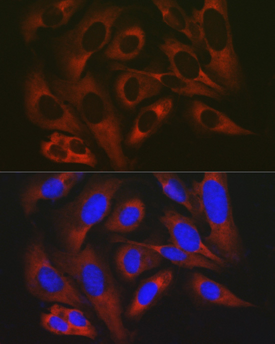 Immunofluorescence analysis of U2OS cells using RPL19 Polyclonal Antibody at dilution of 1:200 (40x lens). Blue: DAPI for nuclear staining.