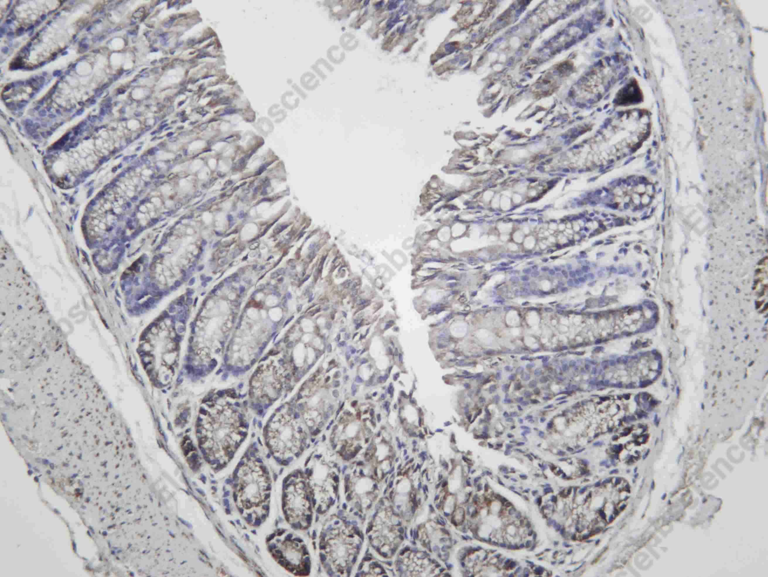 Recombinant LONP1 Monoclonal Antibody - 3