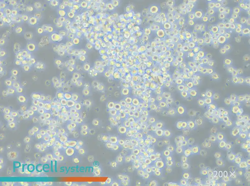 P3X63Ag8.653 Cell Complete Medium - 5