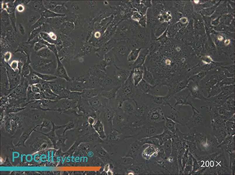 SK-GT-4 Cell Complete Medium - 6