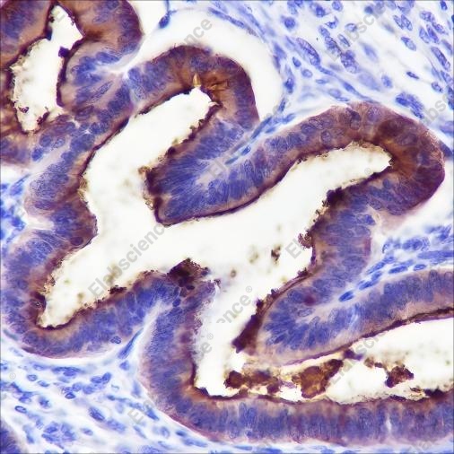 Recombinant MUC1 Monoclonal Antibody - 2