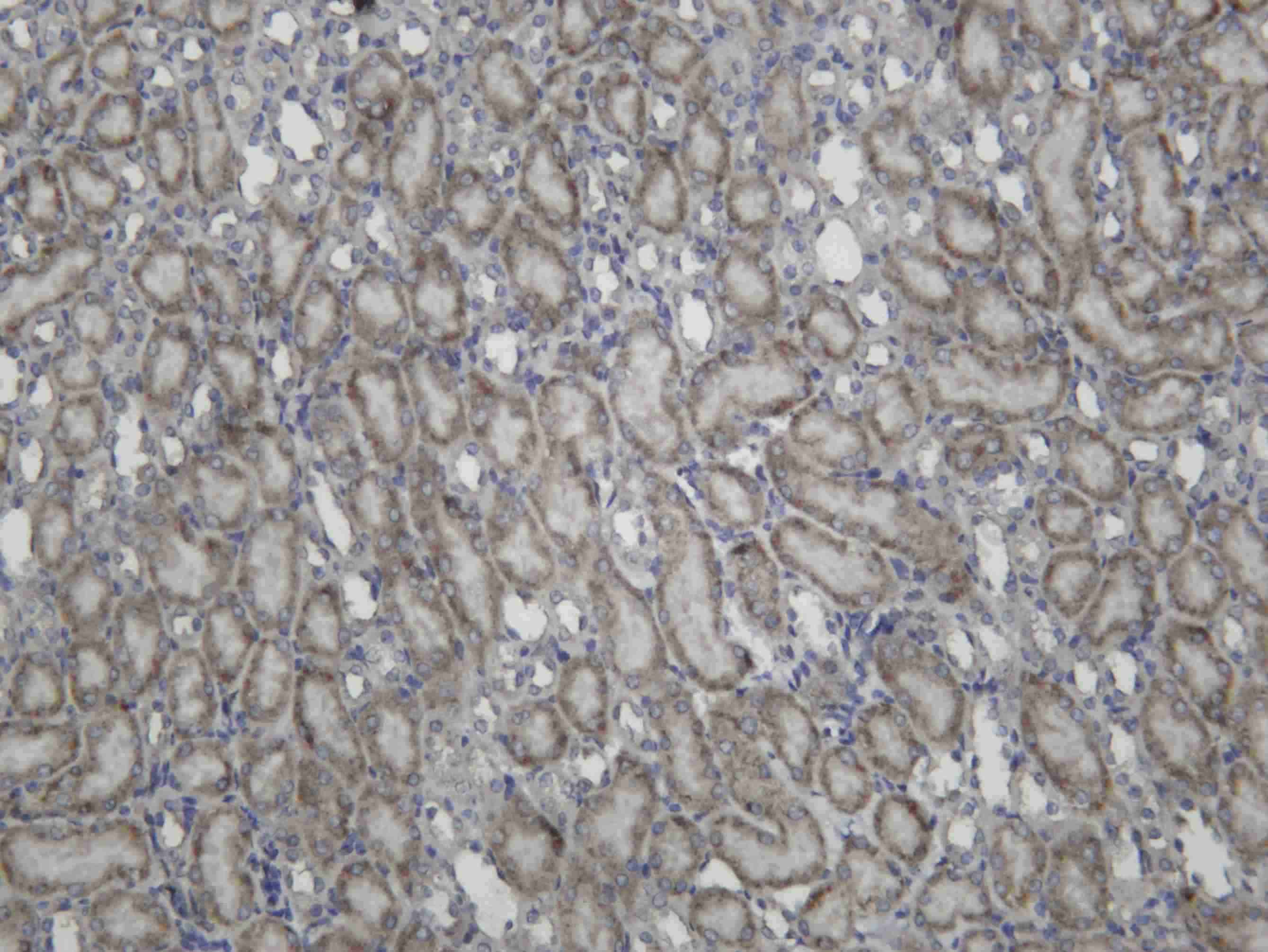 Recombinant FURIN Monoclonal Antibody - 2