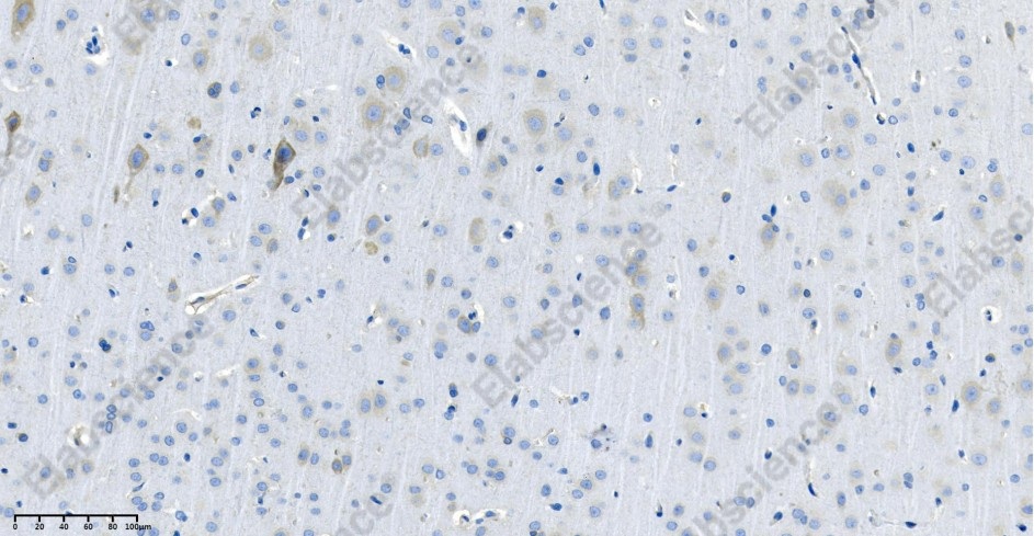 Recombinant Arginase-1 Monoclonal Antibody - 2