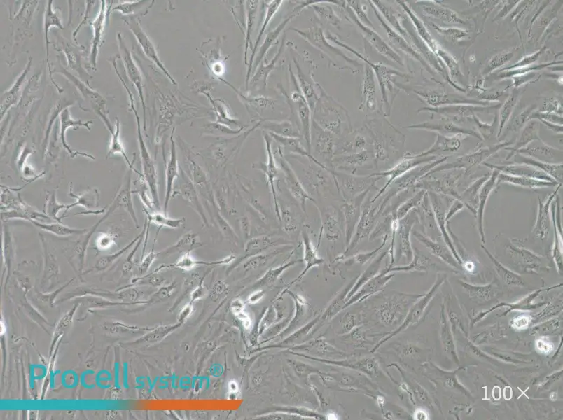 FTC-133 Cell Complete Medium - 1
