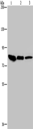 Western Blot analysis of Mouse skin tissue, HUVEC and Hela cell using Catenin gamma Polyclonal Antibody at dilution of 1:850