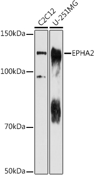 Western blot analysis of extracts of various cell lines using EPHA2 Polyclonal Antibody at 1:1000 dilution.