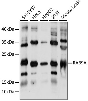 Western blot analysis of extracts of various cell lines using RAB9A Polyclonal Antibody at 1:1000 dilution.