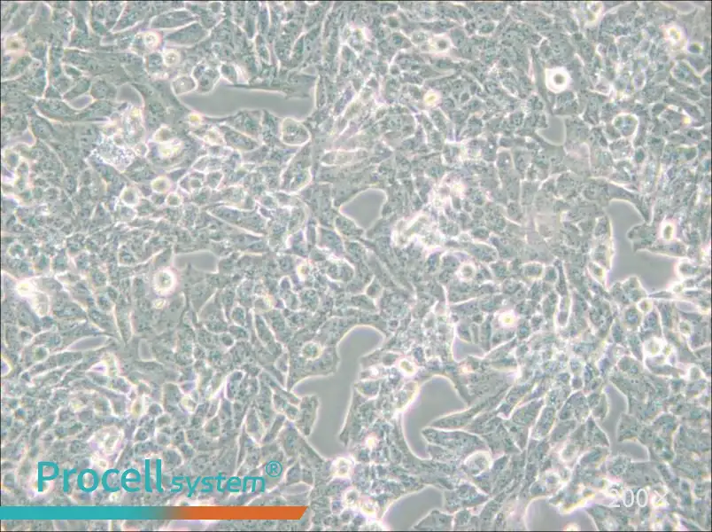 NCI-H295R Cell Complete Medium - small - 6