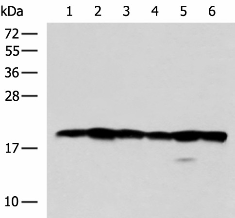 Western blot analysis of 293T Jurkat Hela and 231 cell lysates  using BLOC1S6 Polyclonal Antibody at dilution of 1:600