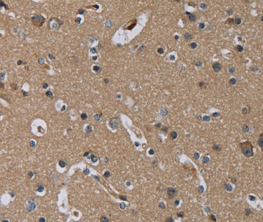 Immunohistochemistry of paraffin-embedded Human brain tissue using PDGFC Polyclonal Antibody at dilution 1:40