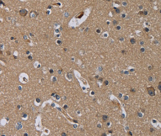 Immunohistochemistry of paraffin-embedded Human brain  tissue using PDGFC Polyclonal Antibody at dilution 1:40