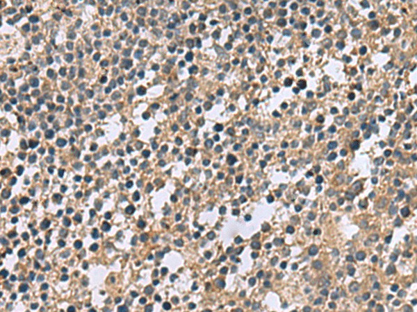 Immunohistochemistry of paraffin-embedded Human tonsil tissue  using CSRP2 Polyclonal Antibody at dilution of 1:60(?200)