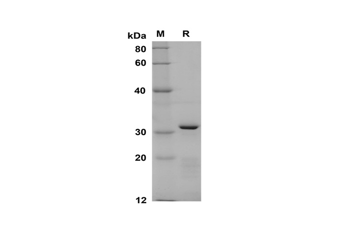 Recombinant Rat CD48 Protein(Fc Tag)-产品推荐-1