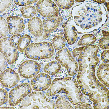 Immunohistochemistry of paraffin-embedded Rat kidney using CDH16 Polyclonal Antibody at dilution of 1:100 (40x lens).