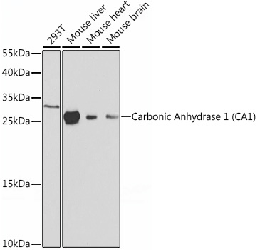 Western blot analysis of extracts of various cell lines using Carbonic Anhydrase 1 Carbonic Anhydrase 1 (CA1) Polyclonal Antibody at 1:1000 dilution.