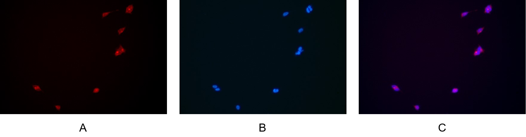 Recombinant PERK Monoclonal Antibody - small - 4