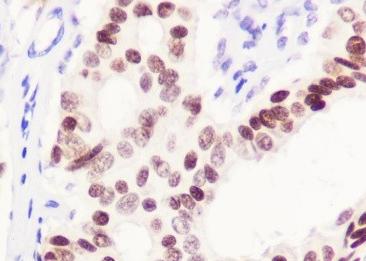 Recombinant GATA3 Monoclonal Antibody-searchlist-3