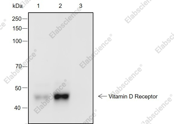 Recombinant Vitamin D Receptor Monoclonal Antibody - 3