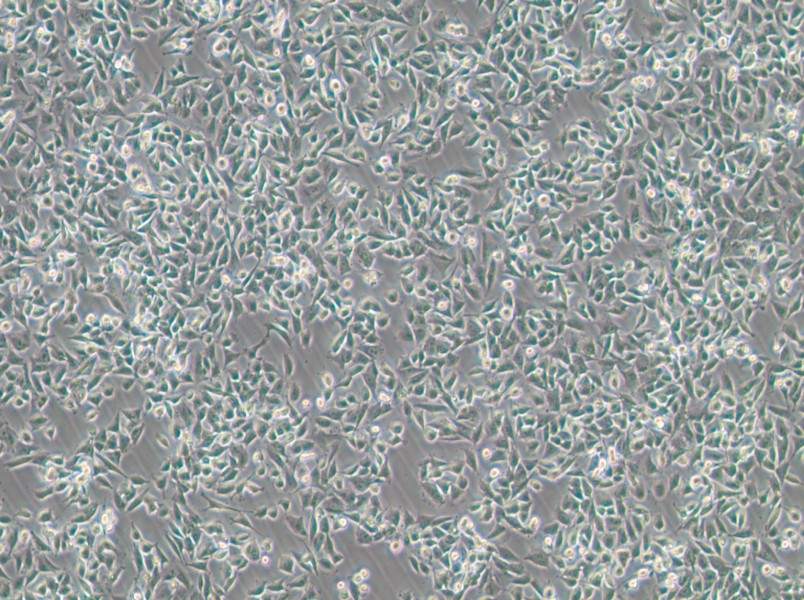 CHP-212 Cell Complete MediumCHP-212 Cell Complete Medium - 3