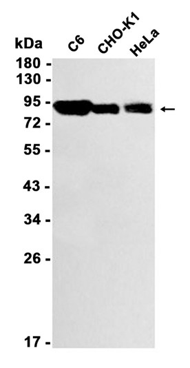 Recombinant beta-Catenin/CTNNB1 Monoclonal Antibody - 1