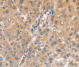 CIAPIN1 Polyclonal Antibody - 3
