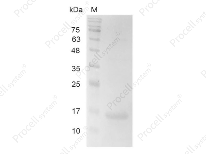 Galectin-2/LGALS2/HL14, Human, Recombinant - 1