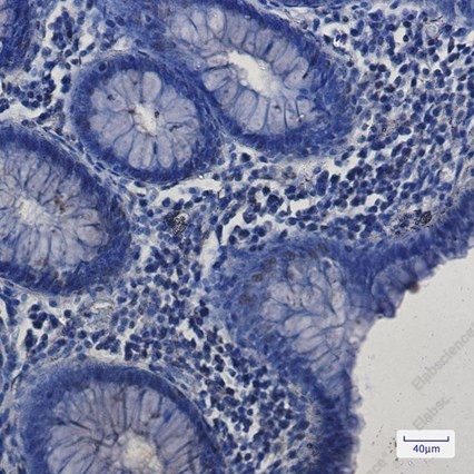 Recombinant SP1 Monoclonal Antibody - 2