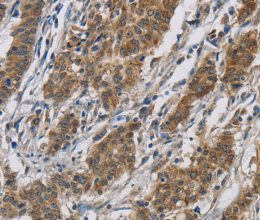 SIGMAR1 Polyclonal Antibody - 2