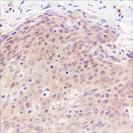 Recombinant PPP1CB Monoclonal Antibody - 2