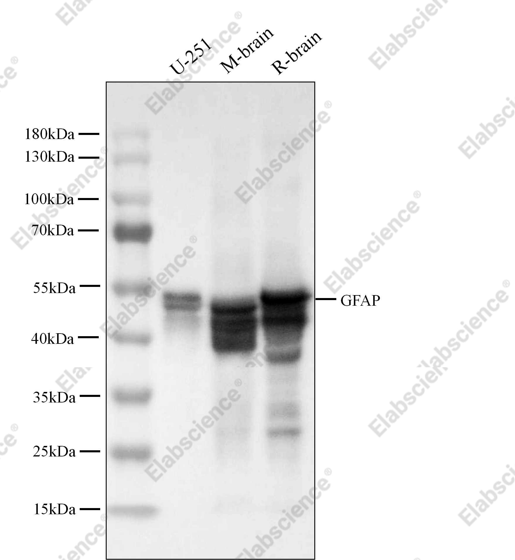 Recombinant GFAP Monoclonal Antibody - 4