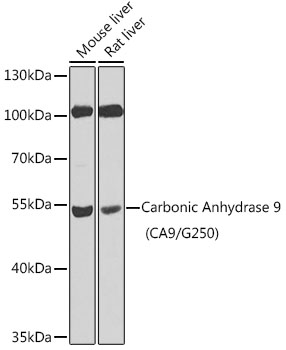 Western blot analysis of extracts of various cell lines using Carbonic Anhydrase 9 (CA9/G250) Polyclonal Antibody at 1:100 dilution.