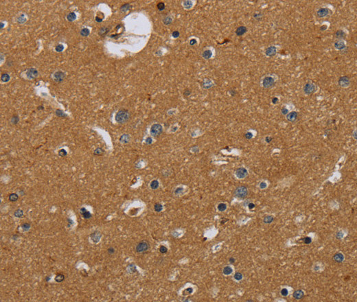 Immunohistochemistry of paraffin-embedded Human brain tissue using Glucocorticoid Receptor Polyclonal Antibody at dilution 1:40