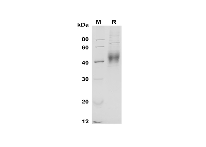 Recombinant Mouse IL2 Protein (His Tag)-产品推荐-1