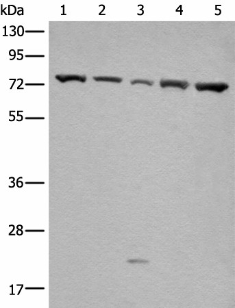 Western blot analysis of Hela and A431 cell Mouse brain tissue HT-29 and Jurkat cell lysates  using GARS Polyclonal Antibody at dilution of 1:540