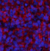 Immunofluorescence analysis of Rat spleen tissue with Phospho-Stat1 (Tyr701) Polyclonal Antibody at dilution of 1:200