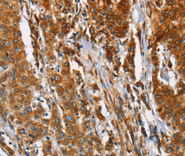 BCAP31 Polyclonal Antibody - 2