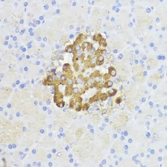 Immunohistochemistry of paraffin-embedded Rat pancreas using Bcl-2 Polyclonal Antibody at dilution of 1:100 (40x lens).