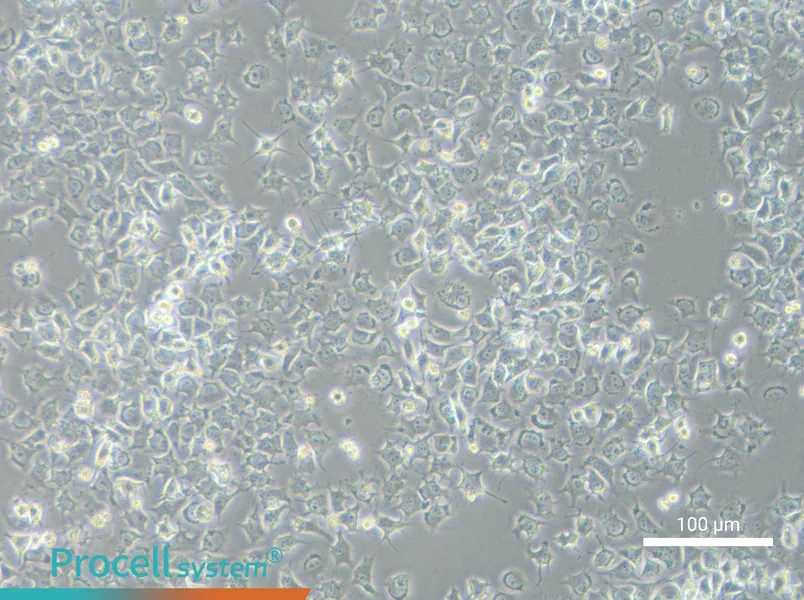 92-1 [Human uveal melanoma]92-1 [Human uveal melanoma] - 2