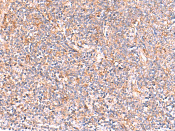 Immunohistochemistry of paraffin-embedded Human tonsil tissue  using NADK Polyclonal Antibody at dilution of 1:95(?200)