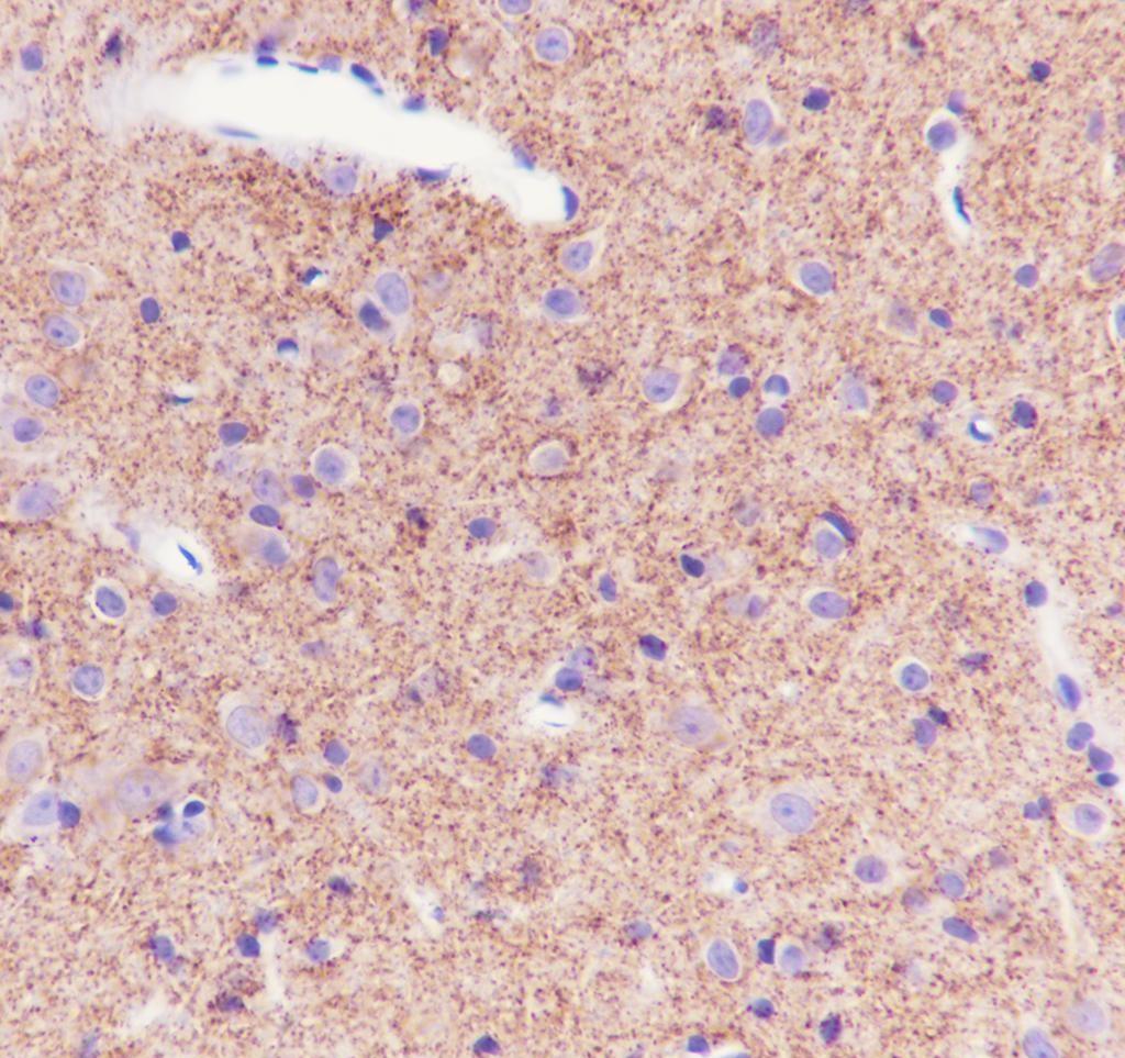 Recombinant SV2A Monoclonal Antibody - small - 6