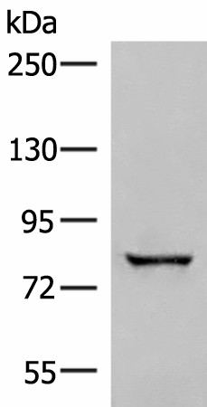 Western blot analysis of Human bladder transitional cell carcinoma grade 2-3 tissue lysate  using TTC12 Polyclonal Antibody at dilution of 1:300